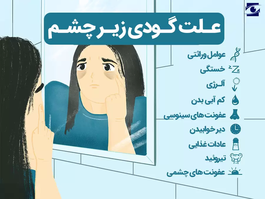 علت گودی زیر چشم